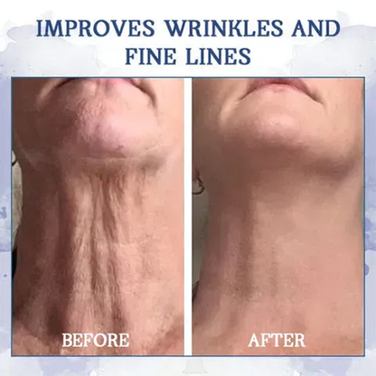 Fivfivgo™ Advanced Firming & Wrinkle-Reducing Cream (Restore Skin Elasticity)