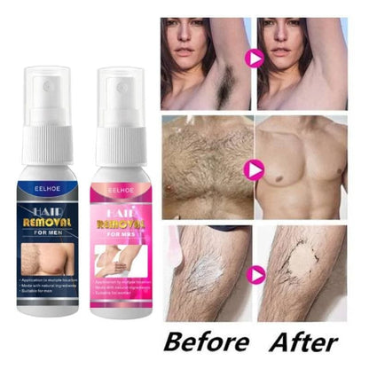 Sobeeriond® Semi-permanent Hair Removal Spray