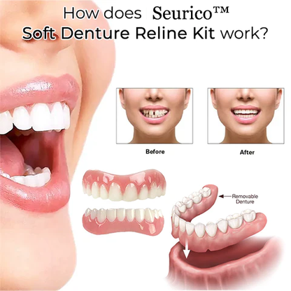 Seurico™ Soft Denture Reline Kit