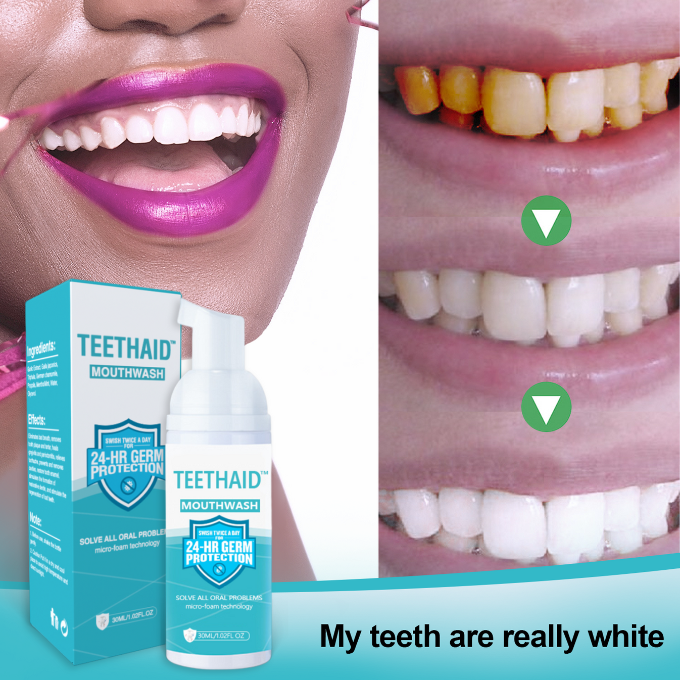Teethaid™ All Natural Herbal Super Whitening and Restorative Mousse for Teeth and Mouth