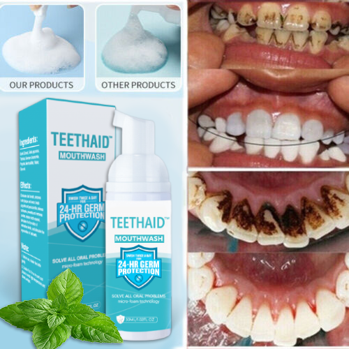 Teethaid™ All Natural Herbal Super Whitening and Restorative Mousse for Teeth and Mouth