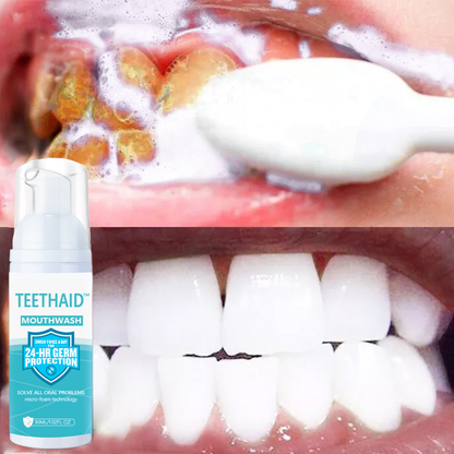 Teethaid™ All Natural Herbal Super Whitening and Restorative Mousse for Teeth and Mouth