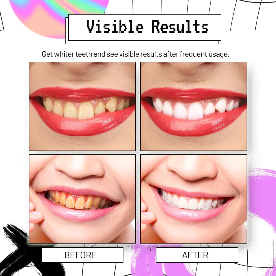 AngelSmile Whitening Purple Mousse Toothpaste