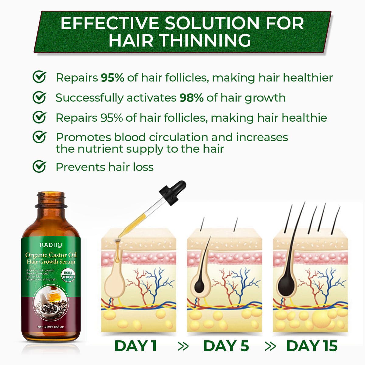 RADIIQ Organic Castor Oil Hair Growth Serum MAX