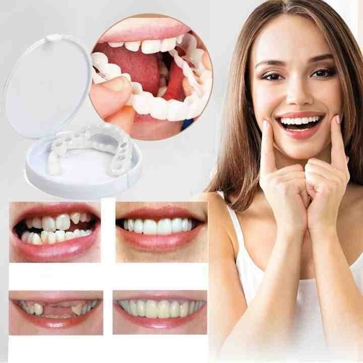 Last day discount-(50%Off)- Adjustable snap-on dentures