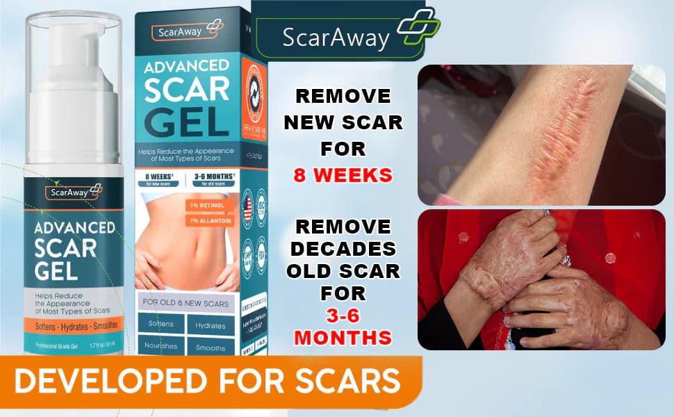 ScarAway®100% Advanced Scar Gel, C-Section Scars, Tummy Tuck, Old Scars, Keloids, Stretch Marks, Burn Scars.