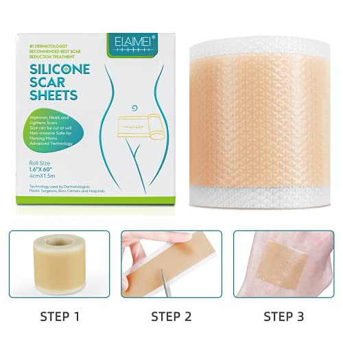 Soft Silicone Gel Tape for Scar Removal (1.6” x 60”)