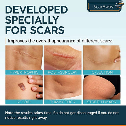 ScarAway®100% Advanced Scar Gel, C-Section Scars, Tummy Tuck, Old Scars, Keloids, Stretch Marks, Burn Scars.