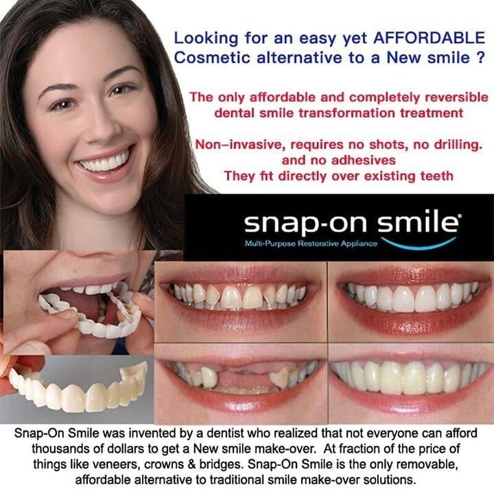 Last day discount-(50%Off)- Adjustable snap-on dentures
