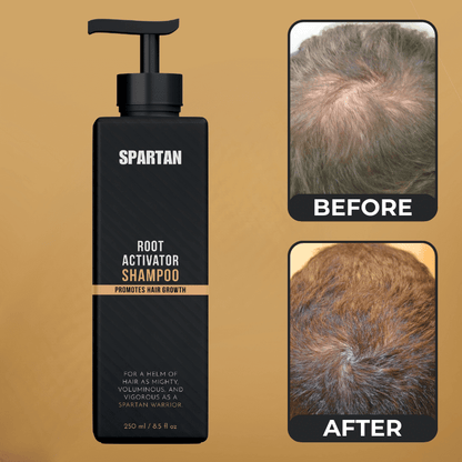 SPARTAN™ - Root Activator Shampoo