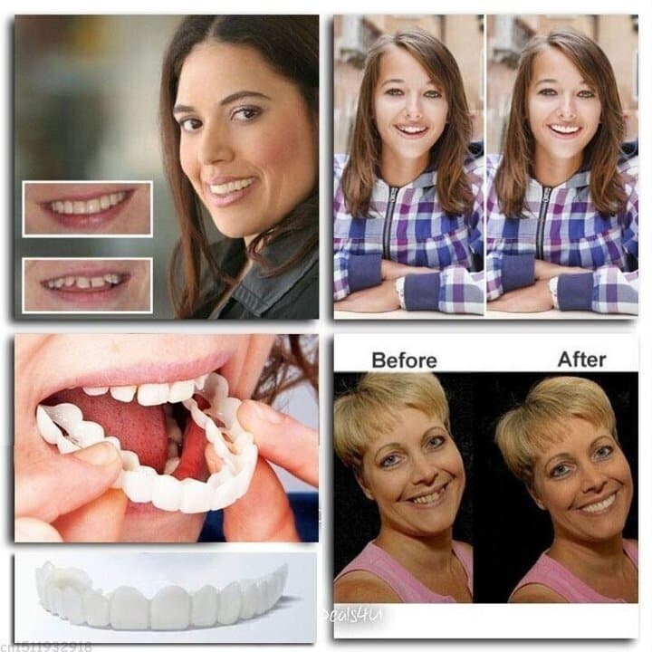 💝💝Last day-discount-75%Off💝💝Latest👨‍⚕Adjustable Snap-On Dentures😁